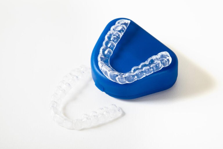 Invisalign in Ahmedabad