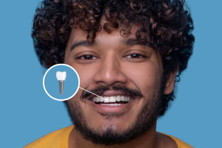 Dental Implant in Law Garden