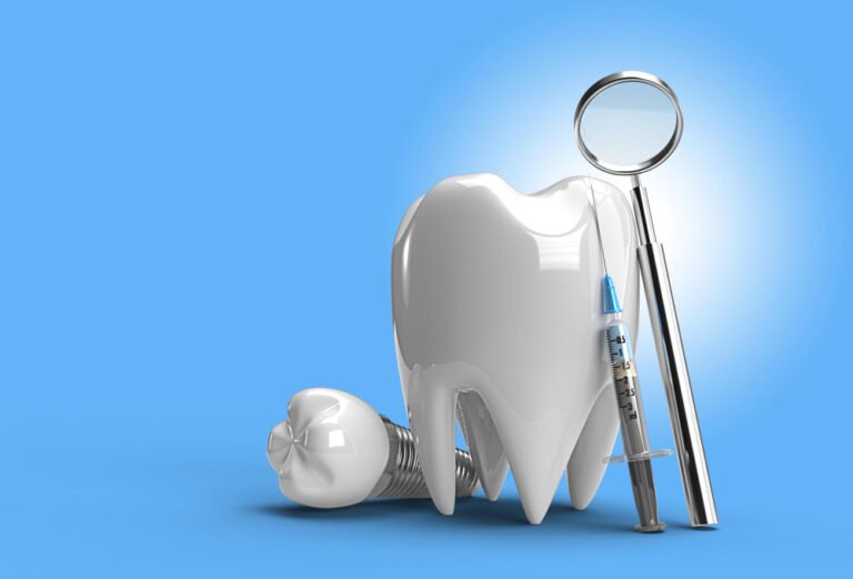 Dental Implant in Law Garden