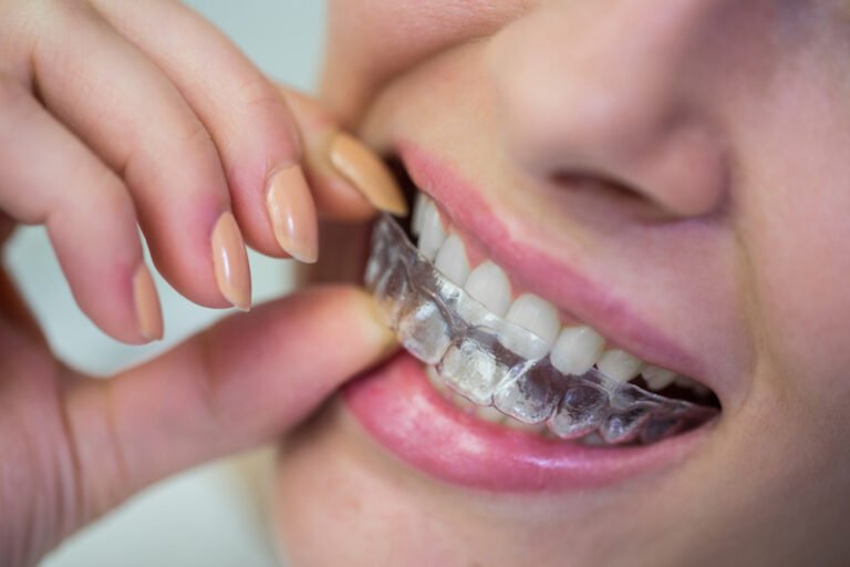 Invisalign in law garden