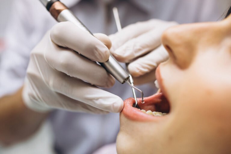 NRI Dental treatment in law garden